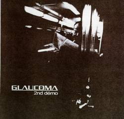 Glaucoma : 2nd Demo